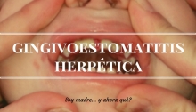 Gingivoestomatitis herpética